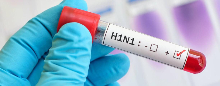 Swine flu strain confirmed in Armenia - Ministry of Health